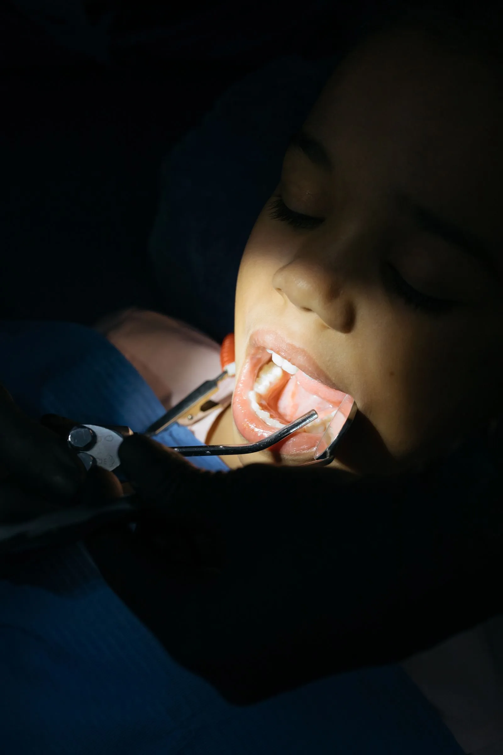 Niño recibiendo un tratamiento dental preventivo en la consulta