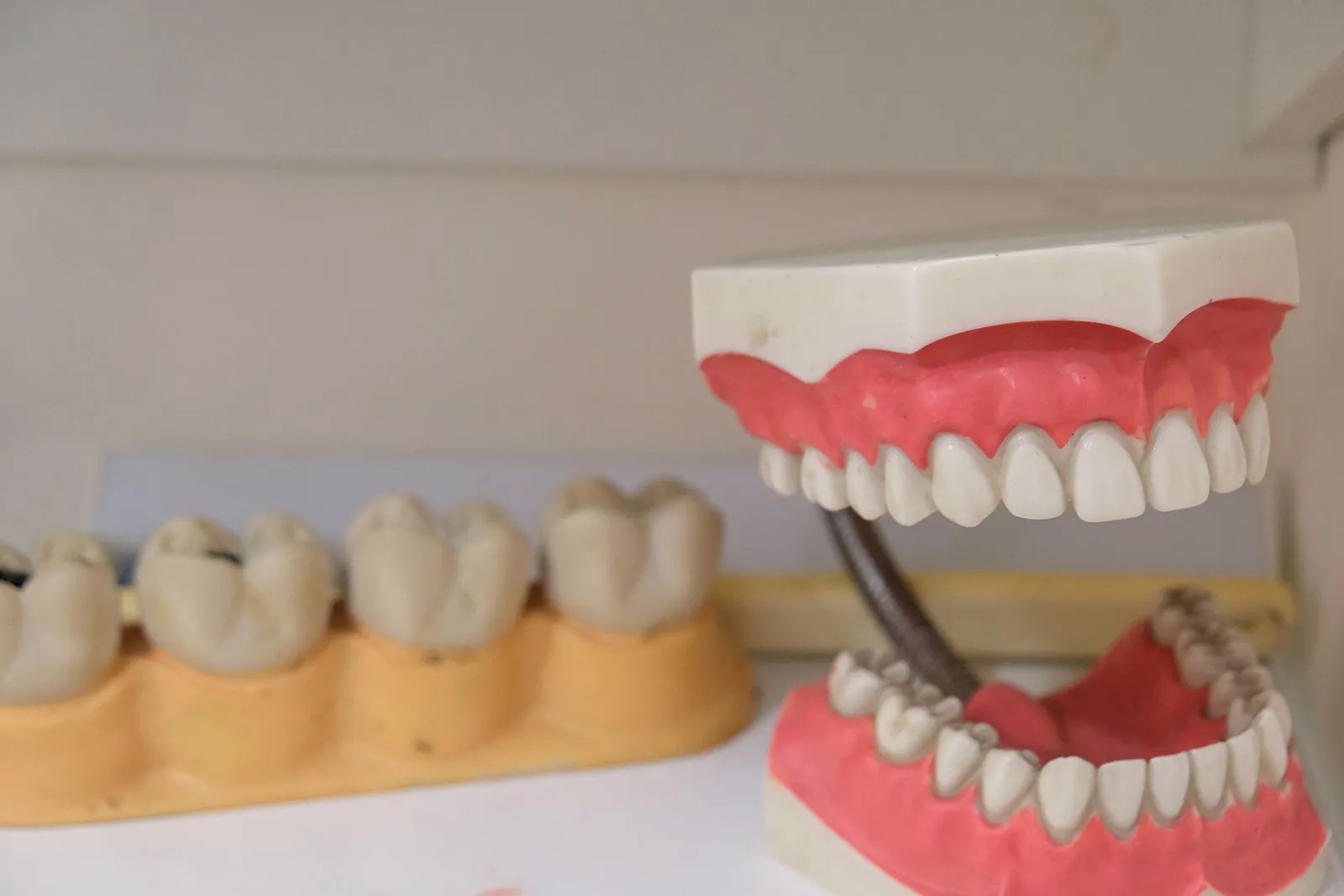 Modelos de prótesis dental y dentadura sobre una superficie de clínica